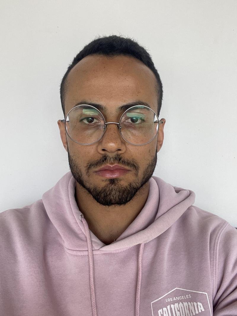 DOUGLAS GALEASE DA SILVA
