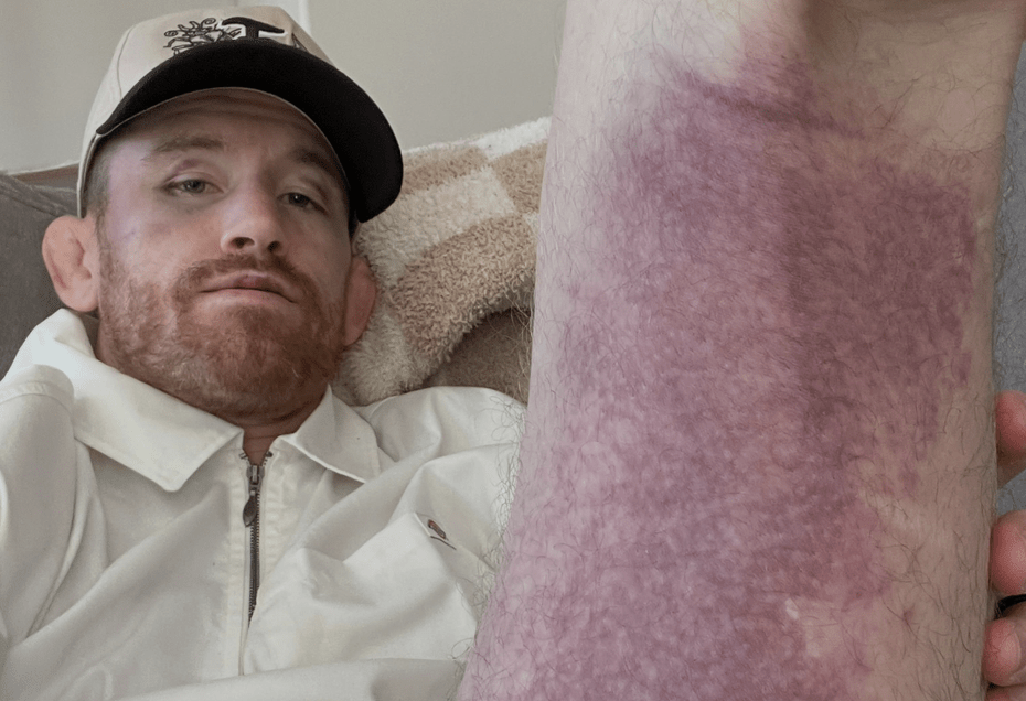 Cory Sandhagen 'Envergonhado' faz declaração após derrota no UFC 329, teme ruptura de isquiotibial — Federação de Jiu-Jitsu