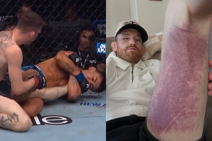 Cory Sandhagen mostra lesão grave no tendão após tentativa de kneebar no UFC 329 — Federação de Jiu-Jitsu